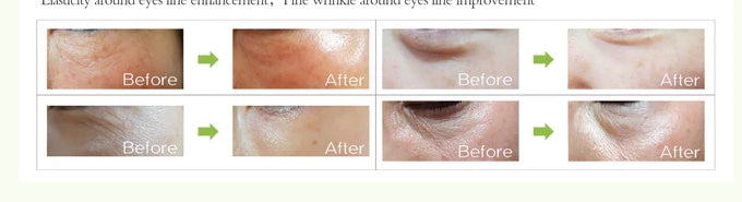 Dr Eye Patch - Wrinkle Repair